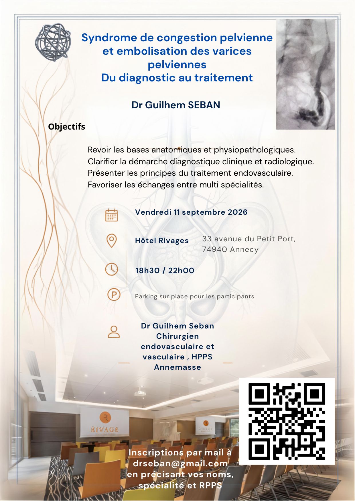 Syndrome de congestion pelvienne et varices pelviennes, du diagnostic au traitement